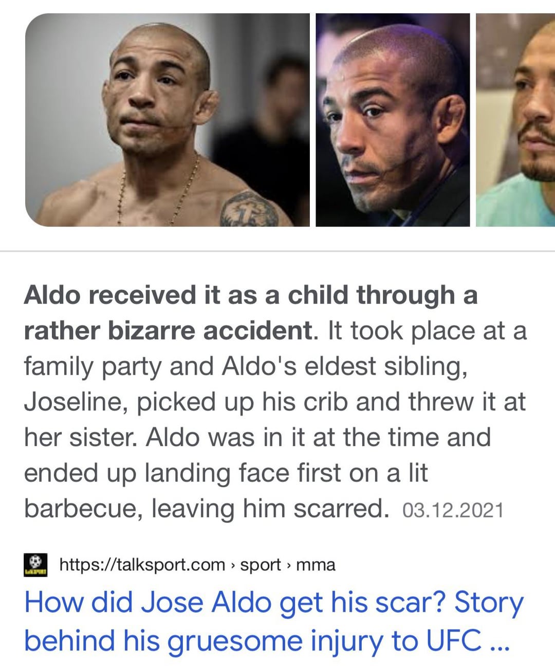 How did Jose Aldo get that scar on his face? Here is the real story behind the UFC fighter!